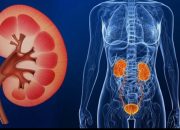 Kasus Gagal Ginjal Melonjak Tajam, Beban BPJS Kesehatan Kini Lampaui Penyakit Kanker