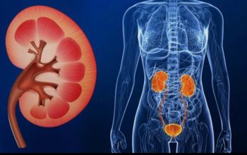 Kasus Gagal Ginjal Melonjak Tajam, Beban BPJS Kesehatan Kini Lampaui Penyakit Kanker